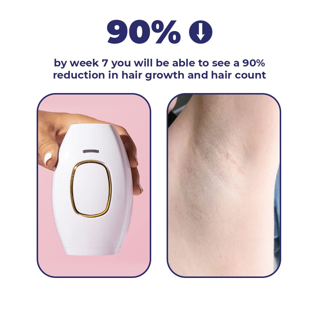 MomDaughts' Portable IPL Hair Remover